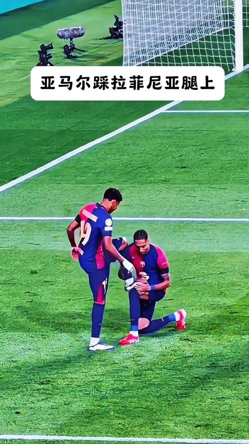 RAC1：拉菲尼亚腿筋受伤，但预计伤势并不严重