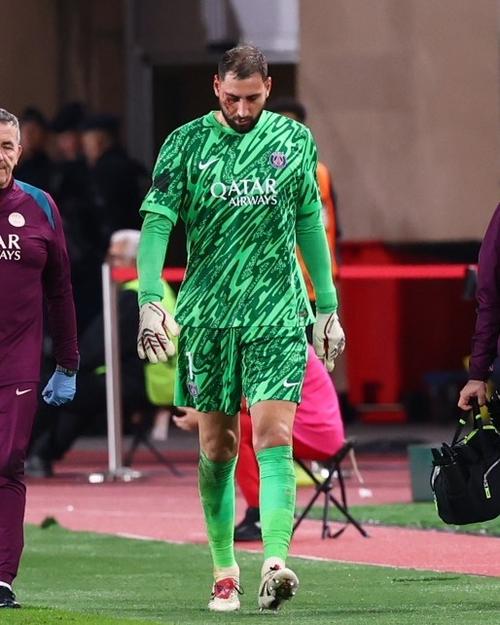 米体:博尼因脚踝受伤单独训练,目前不清楚他是否能参加下轮联赛