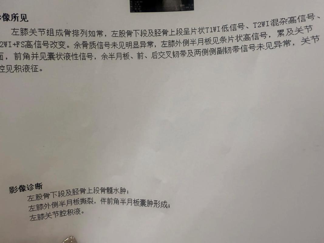 TA:加维伤势原本判断为半月板挫伤,手术检查时才发现是断裂