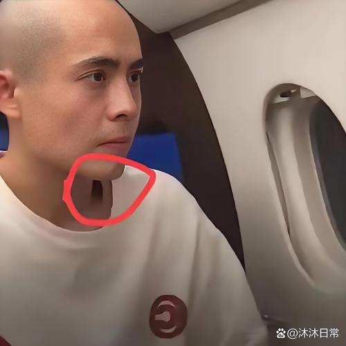 颈部有明显血痕!普理查德:训练营里的对抗像打仗一样